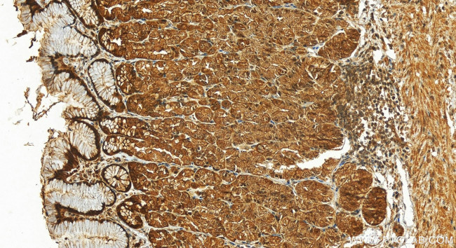 MX2 Antibody in Immunohistochemistry (Paraffin) (IHC (P))