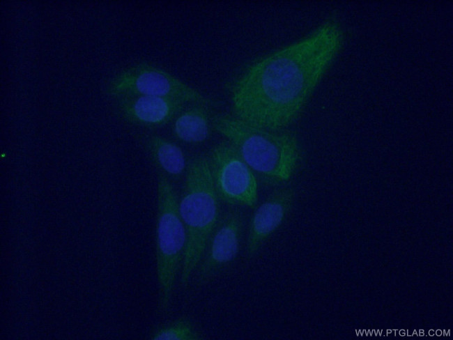 Fibromodulin Antibody in Immunocytochemistry (ICC/IF)