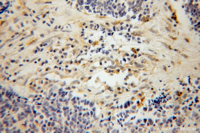 PARVG Antibody in Immunohistochemistry (Paraffin) (IHC (P))
