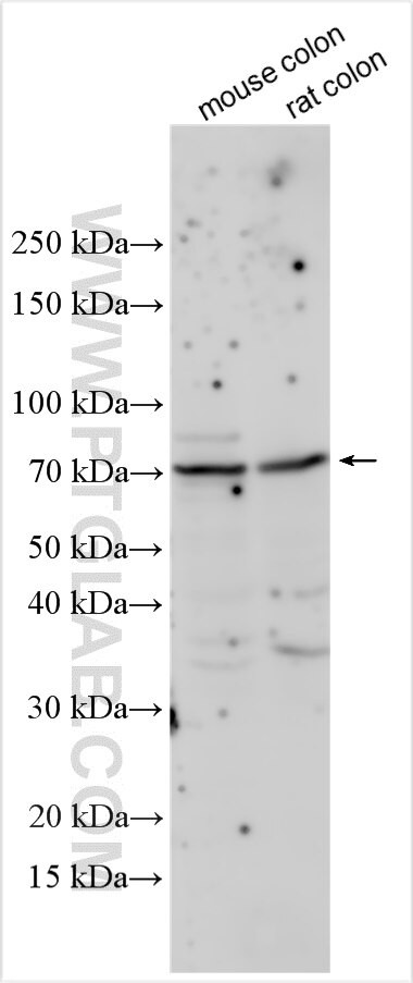 ALOX15 Antibody in Western Blot (WB)