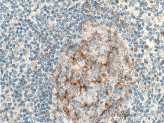 IL12RB1 Antibody in Immunohistochemistry (Paraffin) (IHC (P))