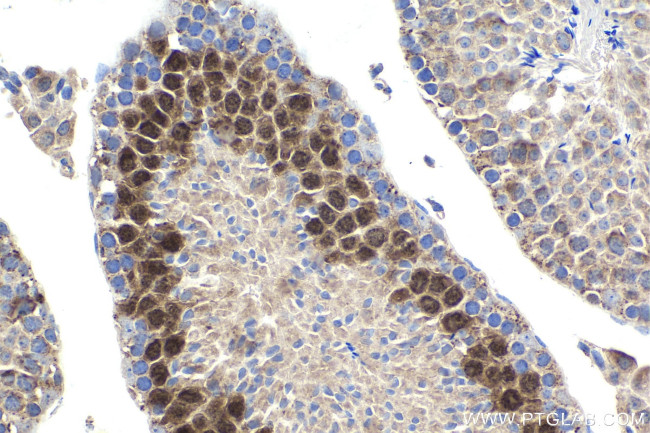 Cyclin A1 Antibody in Immunohistochemistry (Paraffin) (IHC (P))