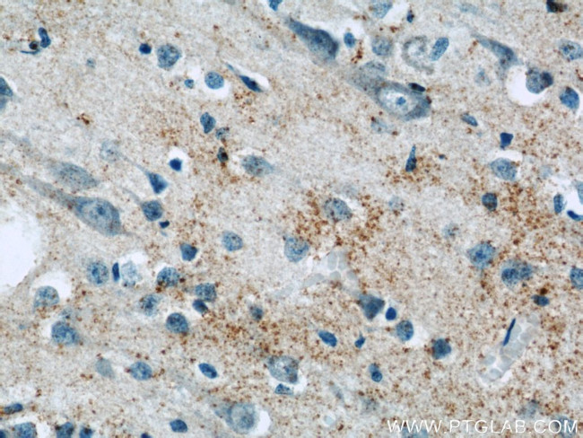 BNP Antibody in Immunohistochemistry (Paraffin) (IHC (P))
