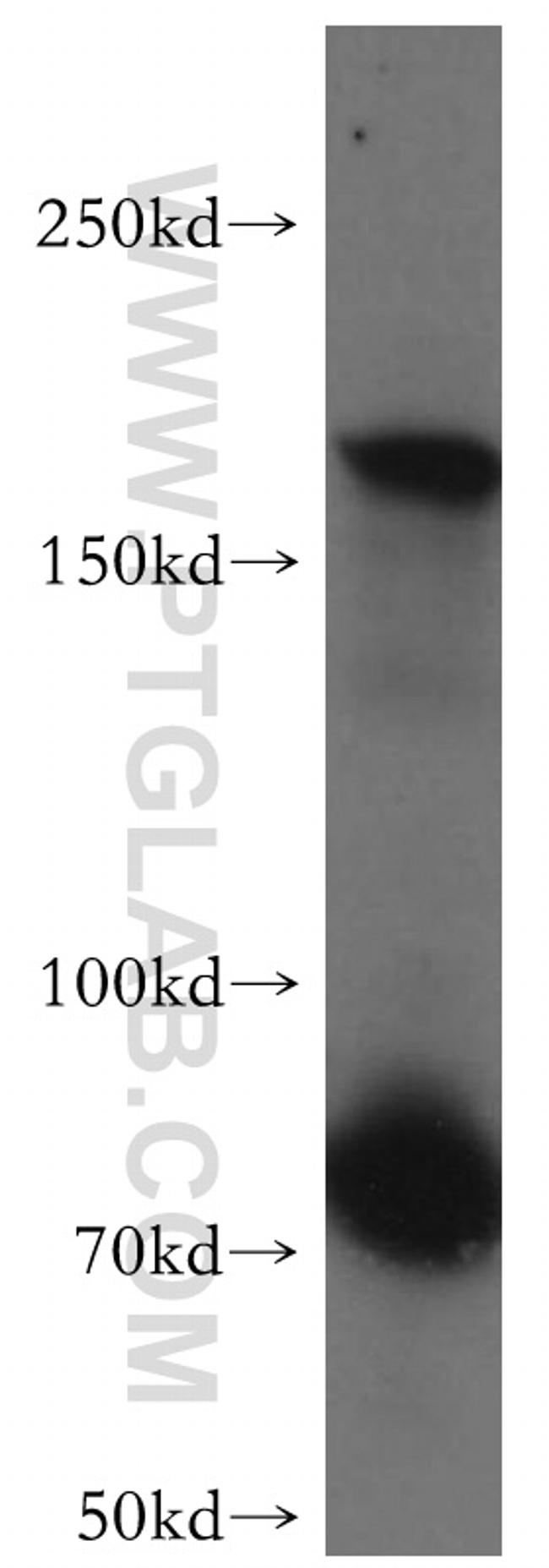 MAST1 Antibody in Western Blot (WB)