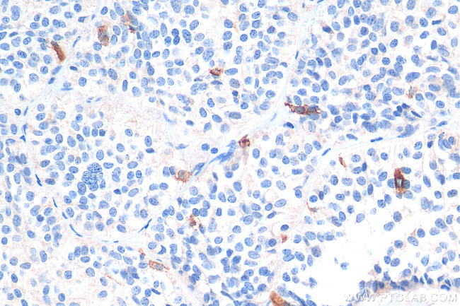 Galanin Antibody in Immunohistochemistry (Paraffin) (IHC (P))