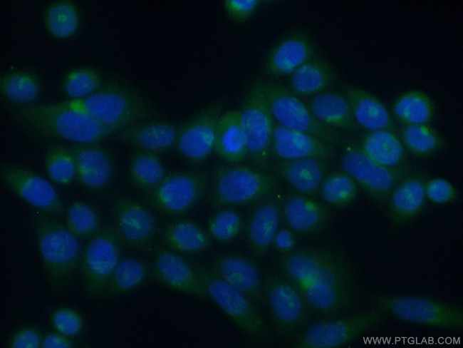 ATP2C1 Antibody in Immunocytochemistry (ICC/IF)