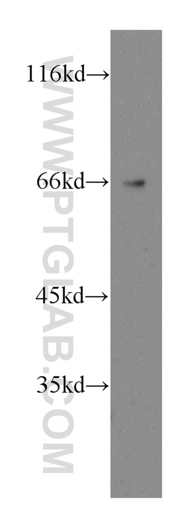 TRAM2 Antibody in Western Blot (WB)