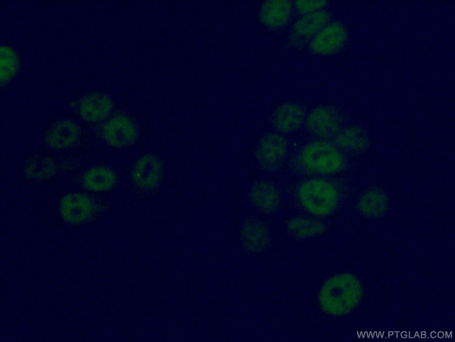 GMEB2 Antibody in Immunocytochemistry (ICC/IF)