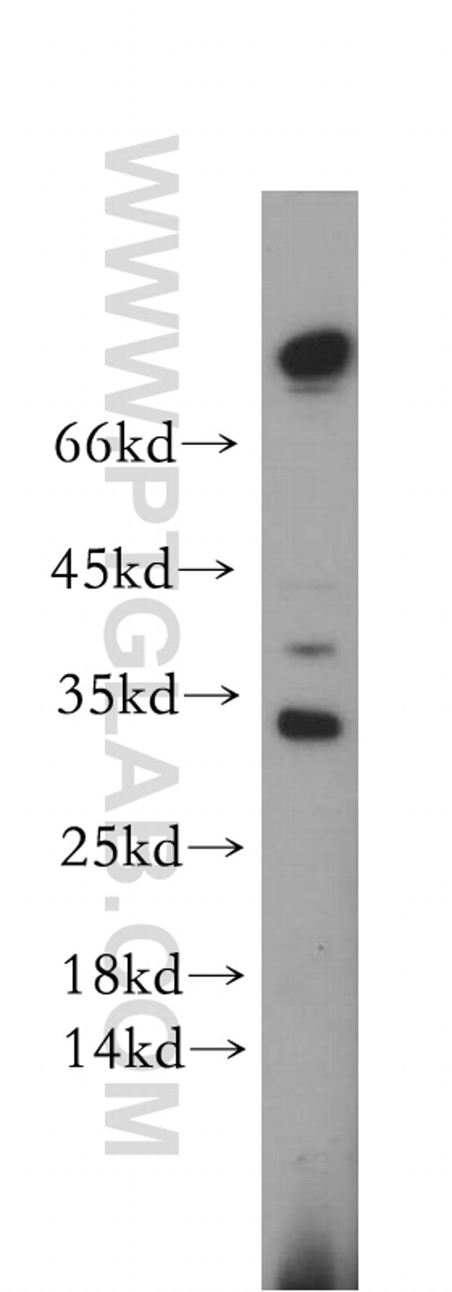 STOML3 Antibody in Western Blot (WB)
