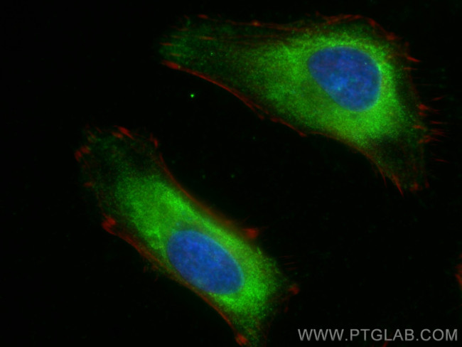 CSDE1 Antibody in Immunocytochemistry (ICC/IF)