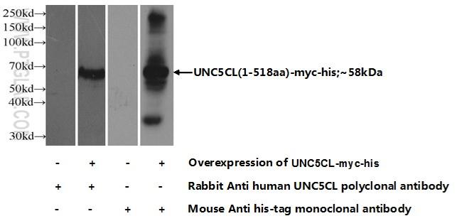 UNC5CL Antibody in Western Blot (WB)