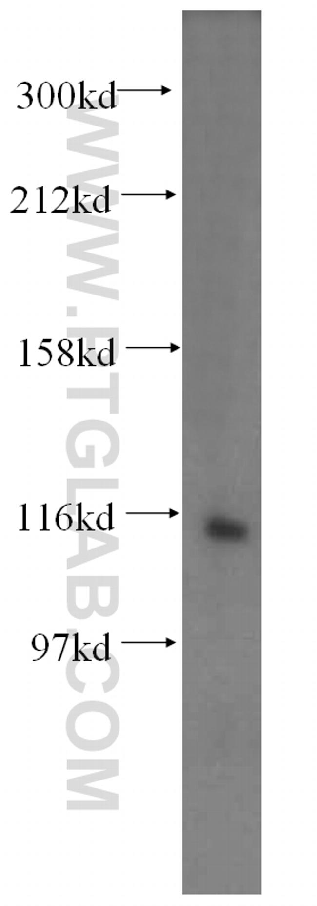 VPS54 Antibody in Western Blot (WB)