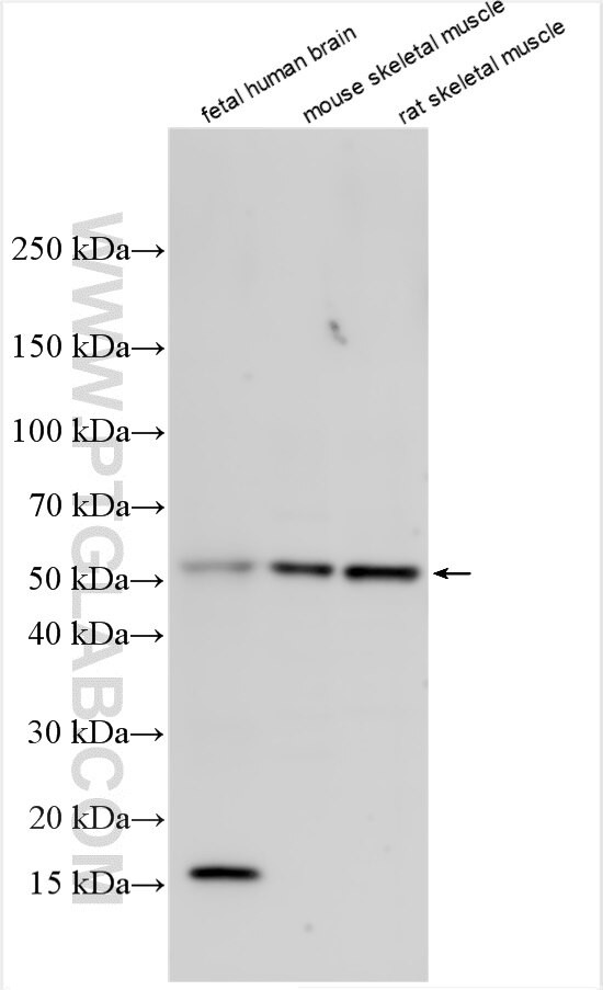 ADAMTSL1 Antibody in Western Blot (WB)