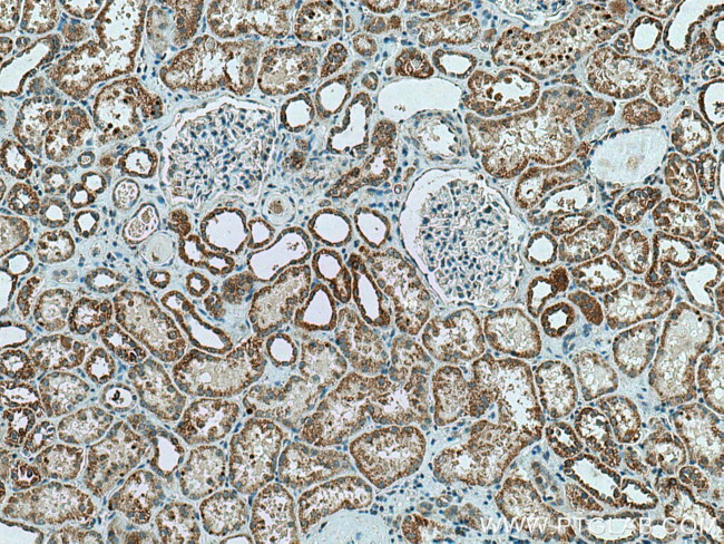 CA5B Antibody in Immunohistochemistry (Paraffin) (IHC (P))