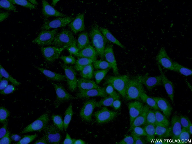 TPSAB1 Antibody in Immunocytochemistry (ICC/IF)