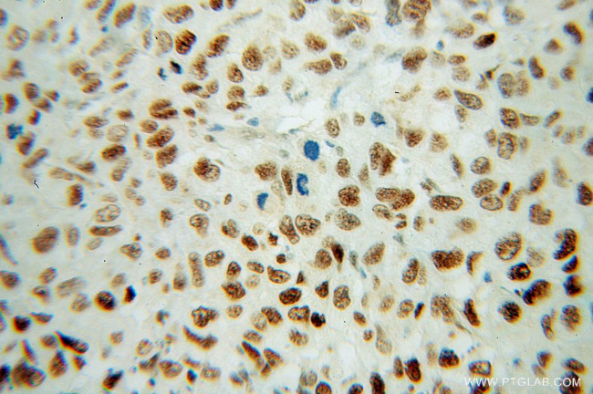 FBLIM1 Antibody in Immunohistochemistry (Paraffin) (IHC (P))