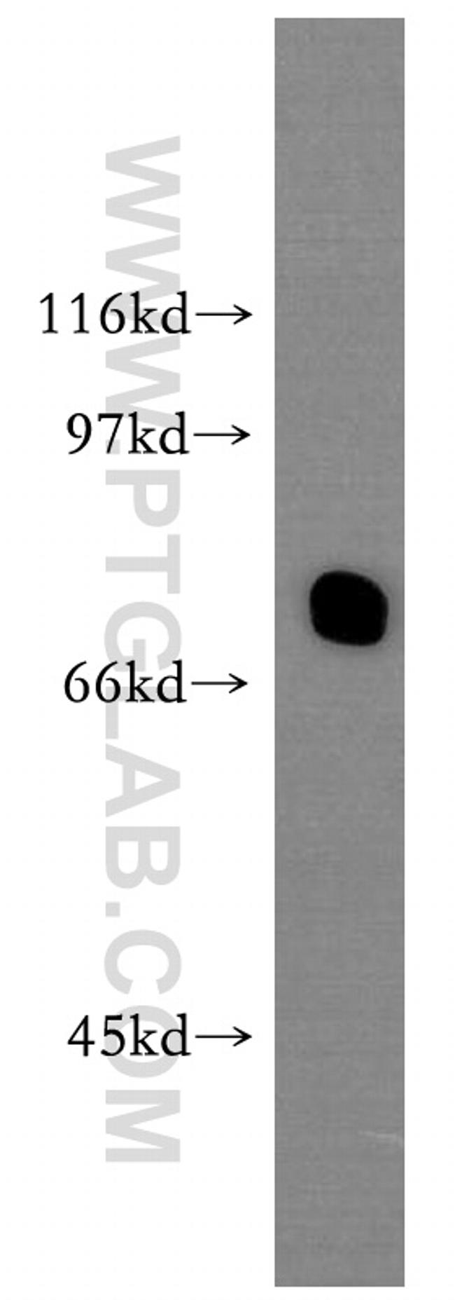 IL10RA Antibody in Western Blot (WB)