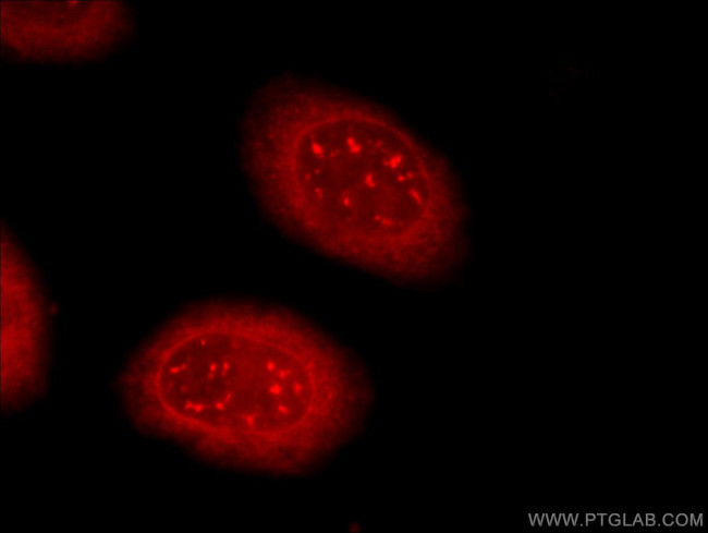 TDRD3 Antibody in Immunocytochemistry (ICC/IF)