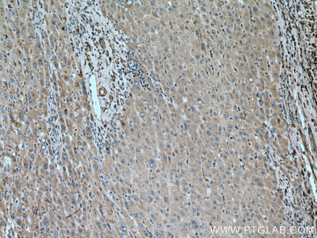 PIP5K3 Antibody in Immunohistochemistry (Paraffin) (IHC (P))