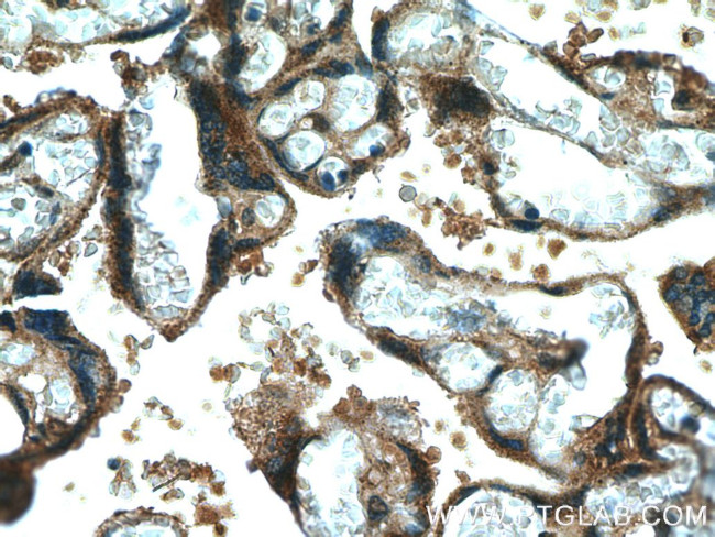 CYP11A1 Antibody in Immunohistochemistry (Paraffin) (IHC (P))