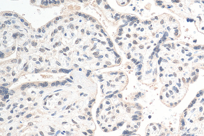 MYNN Antibody in Immunohistochemistry (Paraffin) (IHC (P))