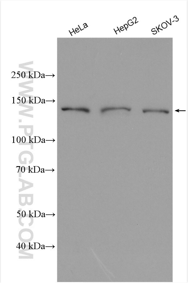 AP3B1 Antibody in Western Blot (WB)