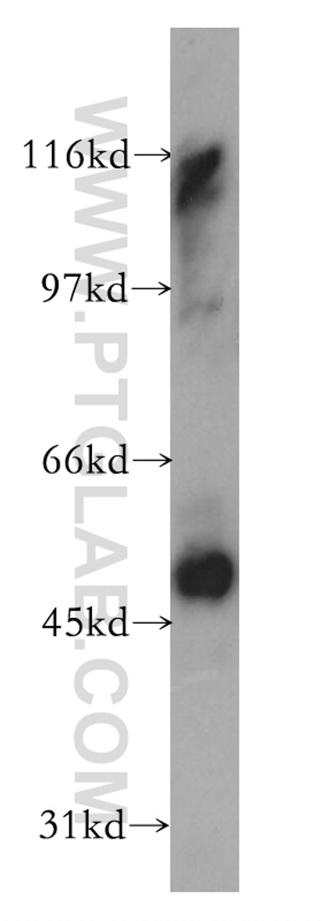 CCRL2 Antibody in Western Blot (WB)