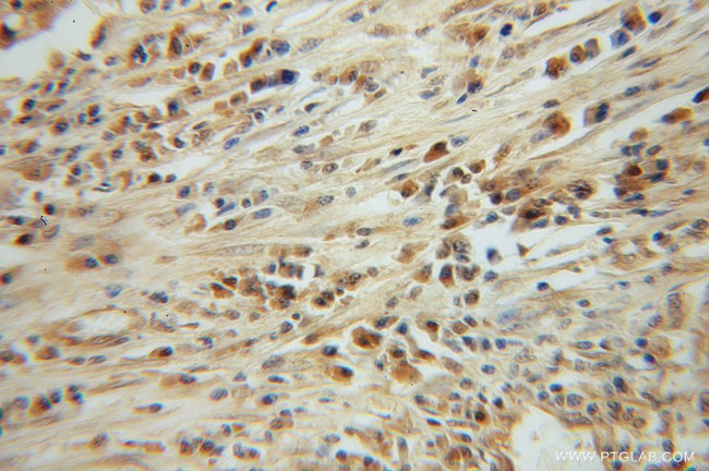 CLEC1A Antibody in Immunohistochemistry (Paraffin) (IHC (P))