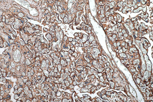 GPR161 Antibody in Immunohistochemistry (Paraffin) (IHC (P))