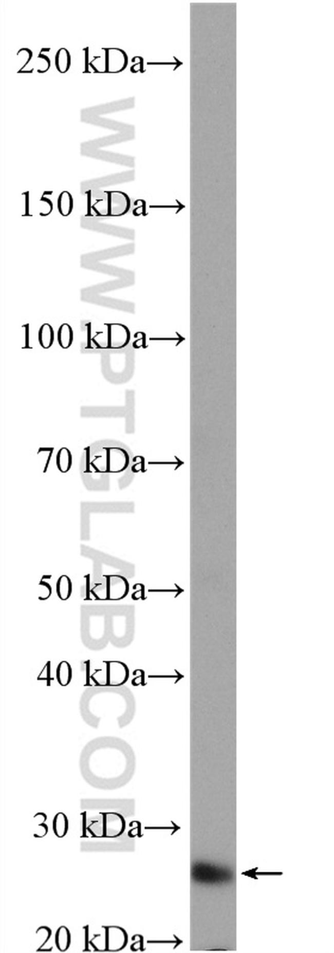 PAQR4 Antibody in Western Blot (WB)