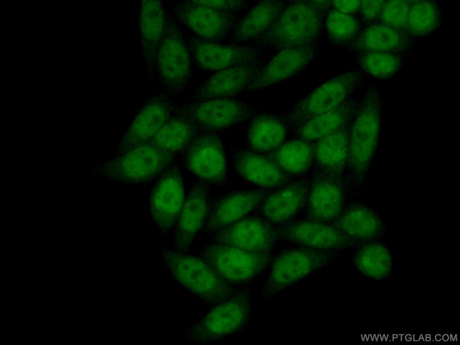 CHD9 Antibody in Immunocytochemistry (ICC/IF)