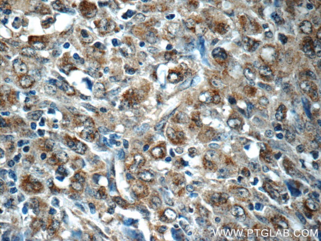 PDP2 Antibody in Immunohistochemistry (Paraffin) (IHC (P))