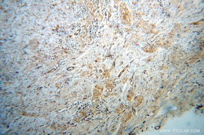 HRH1 Antibody in Immunohistochemistry (Paraffin) (IHC (P))