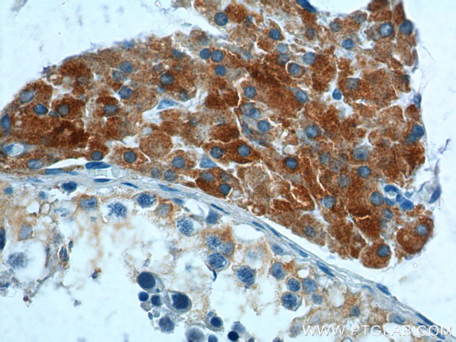 HSD17B3 Antibody in Immunohistochemistry (Paraffin) (IHC (P))