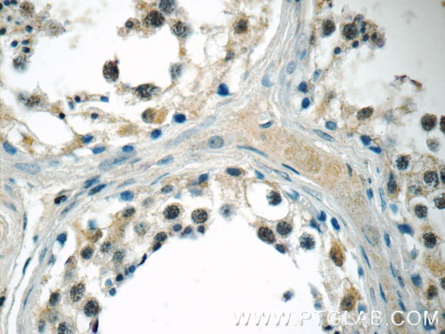 MED19 Antibody in Immunohistochemistry (Paraffin) (IHC (P))