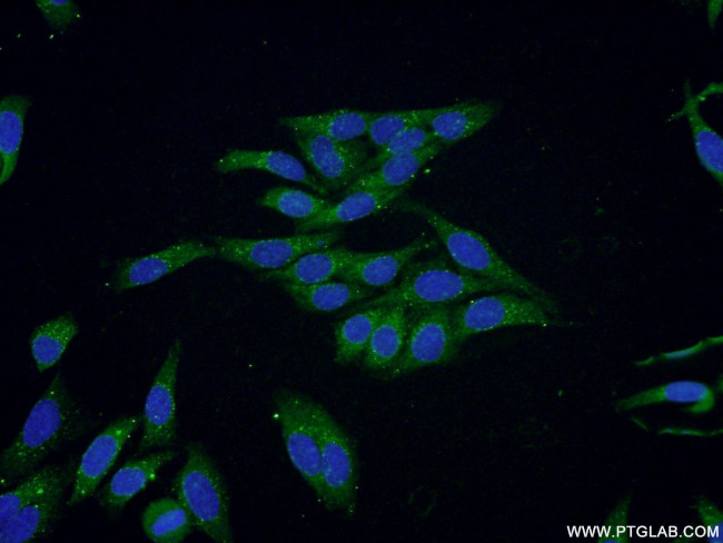 NDUFV3 Antibody in Immunocytochemistry (ICC/IF)