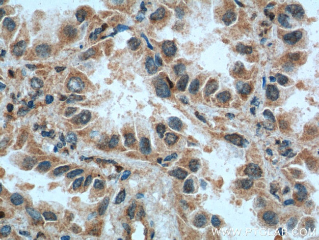 CSRP1 Antibody in Immunohistochemistry (Paraffin) (IHC (P))