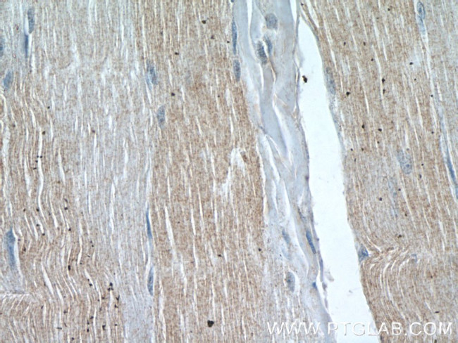 Twinkle Antibody in Immunohistochemistry (Paraffin) (IHC (P))