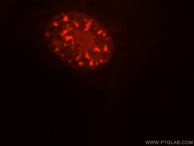 SFRS17A Antibody in Immunocytochemistry (ICC/IF)