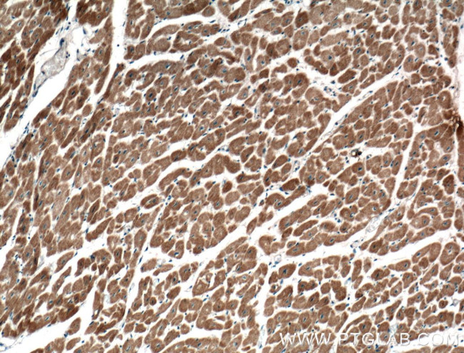 GIMAP2 Antibody in Immunohistochemistry (Paraffin) (IHC (P))
