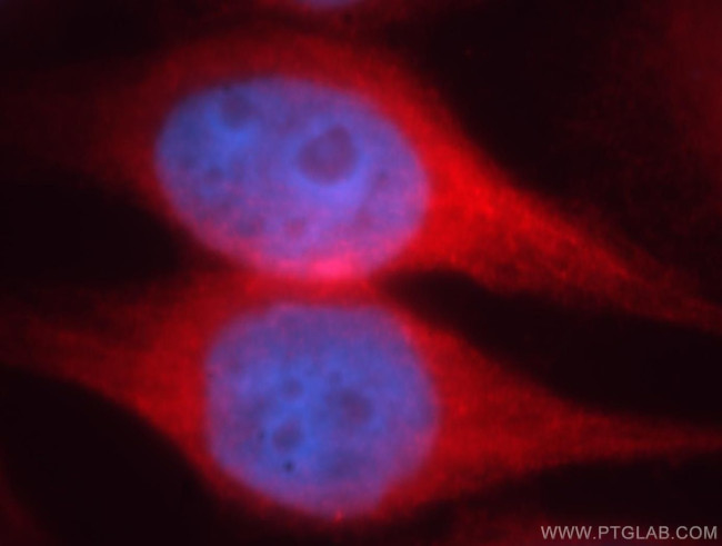 MAP7 Antibody in Immunocytochemistry (ICC/IF)