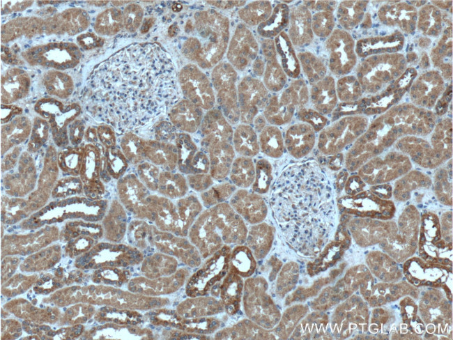 MAPK15 Antibody in Immunohistochemistry (Paraffin) (IHC (P))