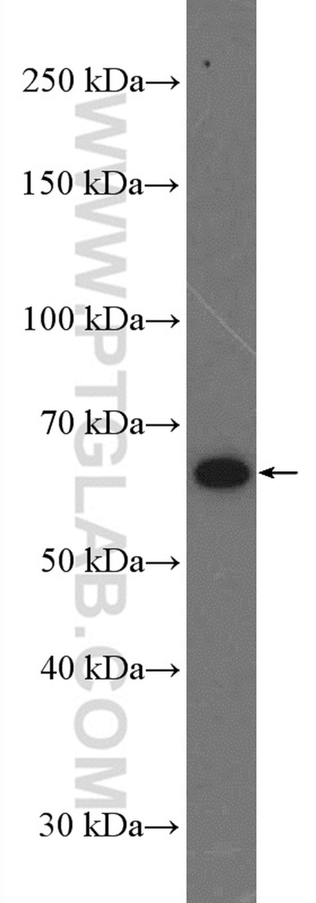 MEI1 Antibody in Western Blot (WB)