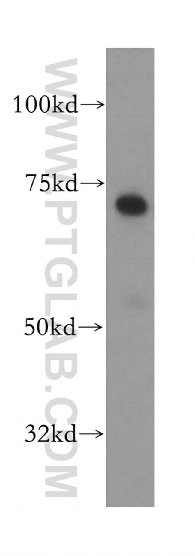 RHPN1 Antibody in Western Blot (WB)