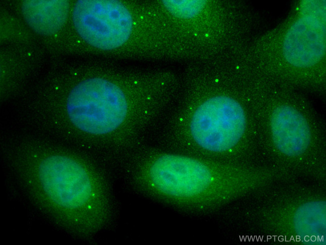CABLES1 Antibody in Immunocytochemistry (ICC/IF)