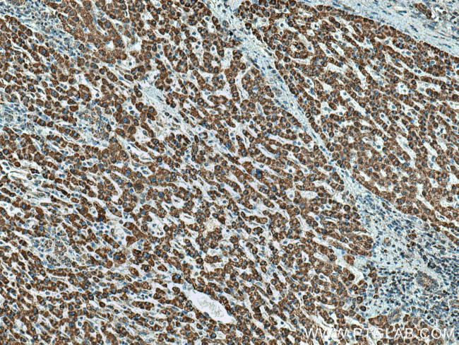 HIBADH Antibody in Immunohistochemistry (Paraffin) (IHC (P))