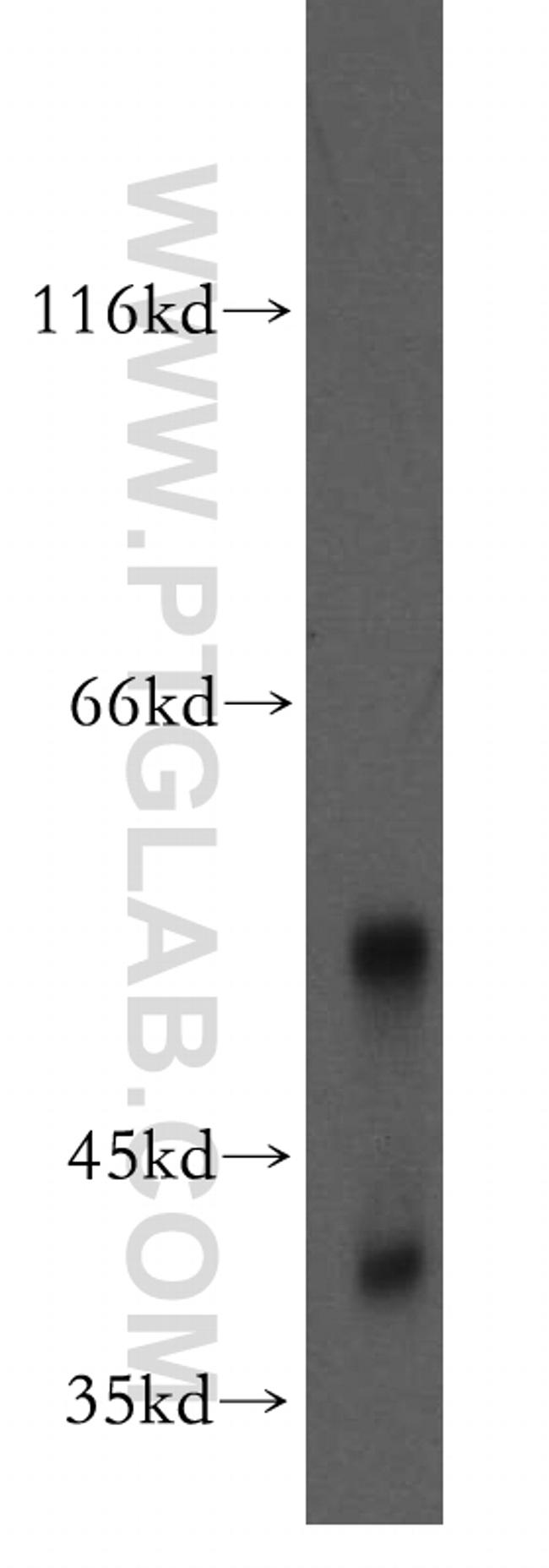 CD72 Antibody in Western Blot (WB)
