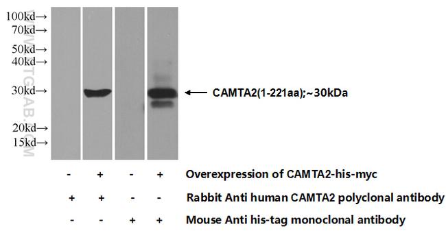 CAMTA2 Antibody in Western Blot (WB)