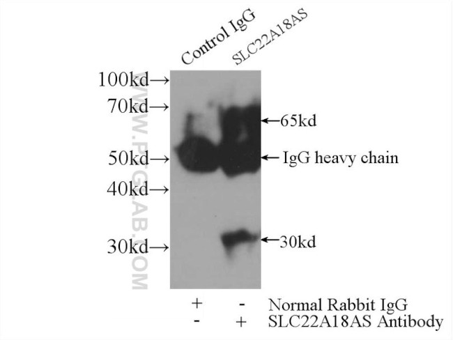 SLC22A18AS Antibody in Immunoprecipitation (IP)
