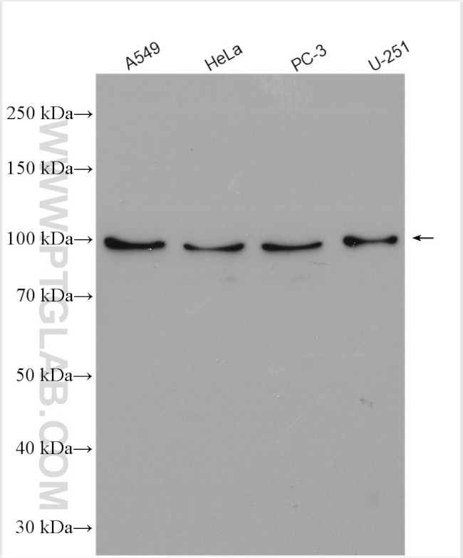 NLGN4Y Antibody in Western Blot (WB)